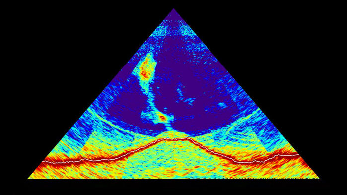 A SONAR image showing the birth of an underwater volcano