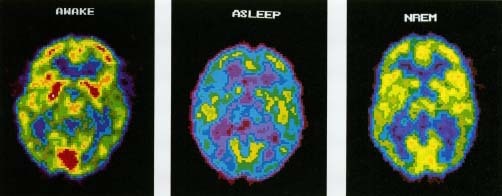 sleep-to-rest-and-shrink-your-brain-youngzine-science