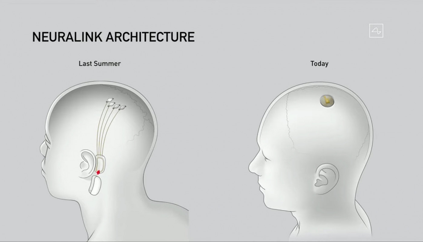 Neuralink: A Chip Inside Your Brain! | Youngzine Technology