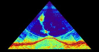 SONAR image of underwater volcano